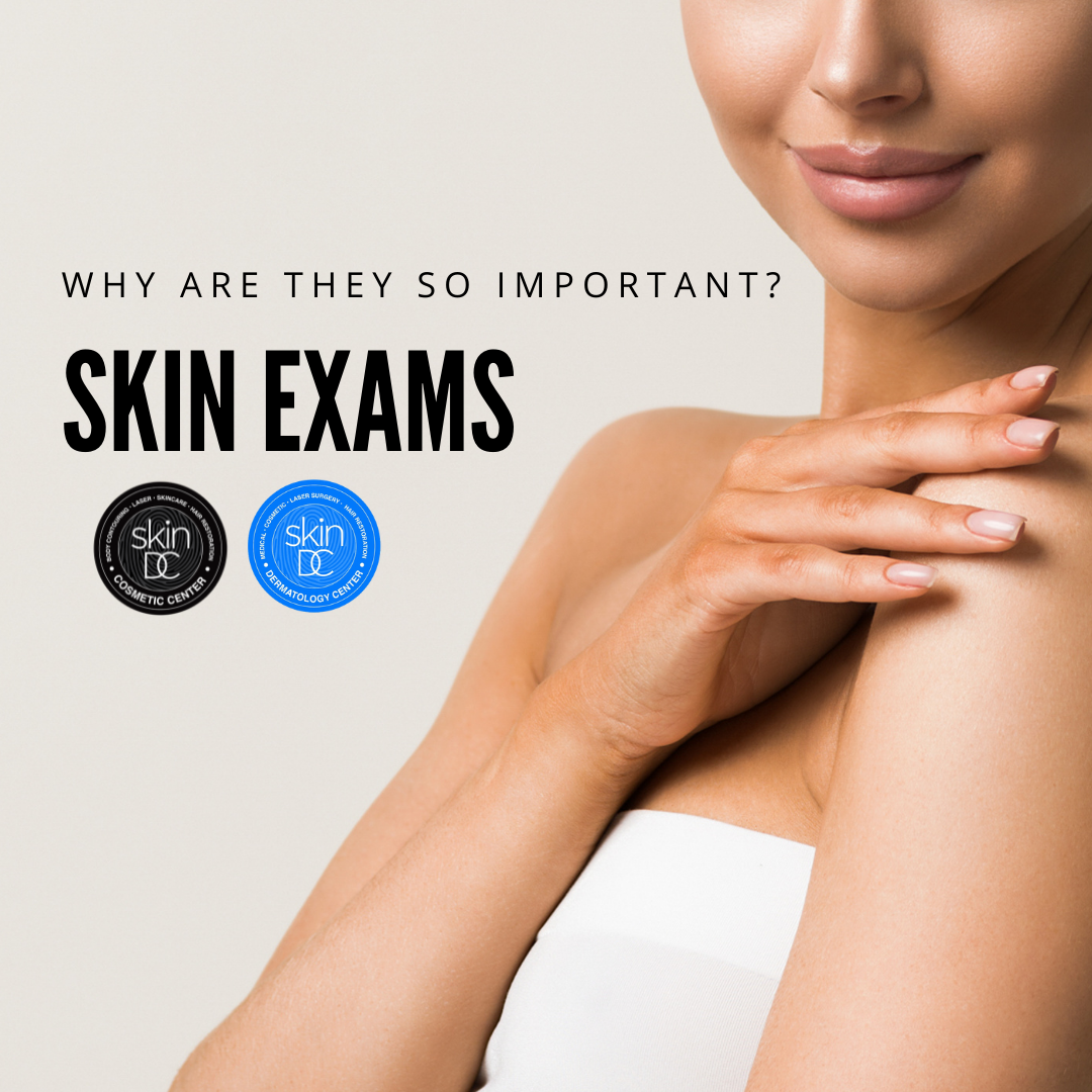 Why are skin exams so important? SkinDC Skin Cancer