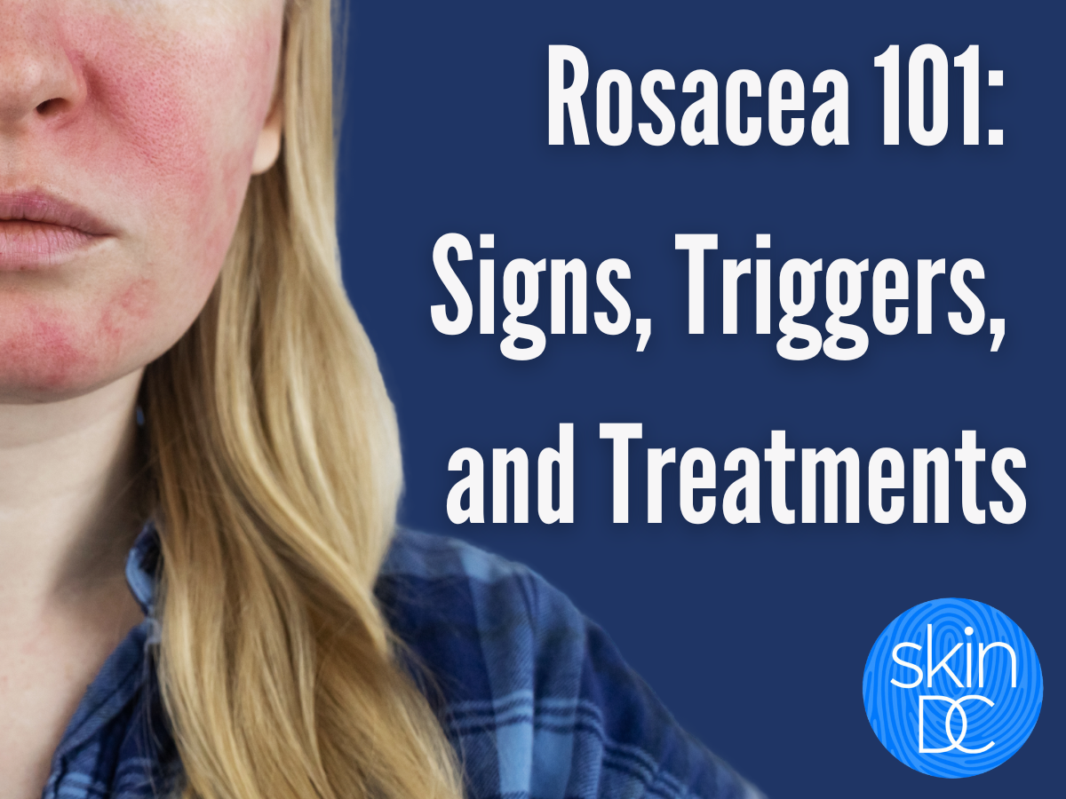 rosacea, redness skin condition dermatologist