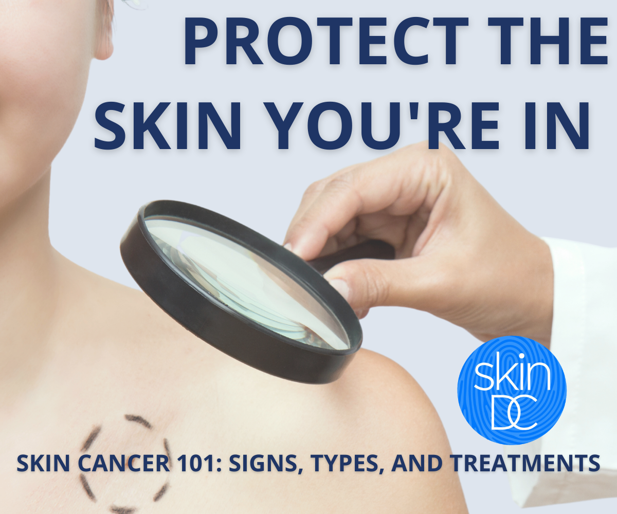 Skin Cancer 101: Signs, Types and Treatments