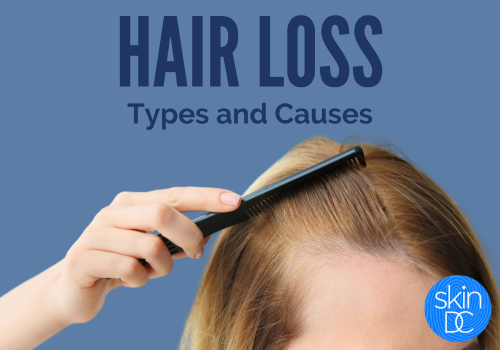 hair loss male and female pattern baldness
