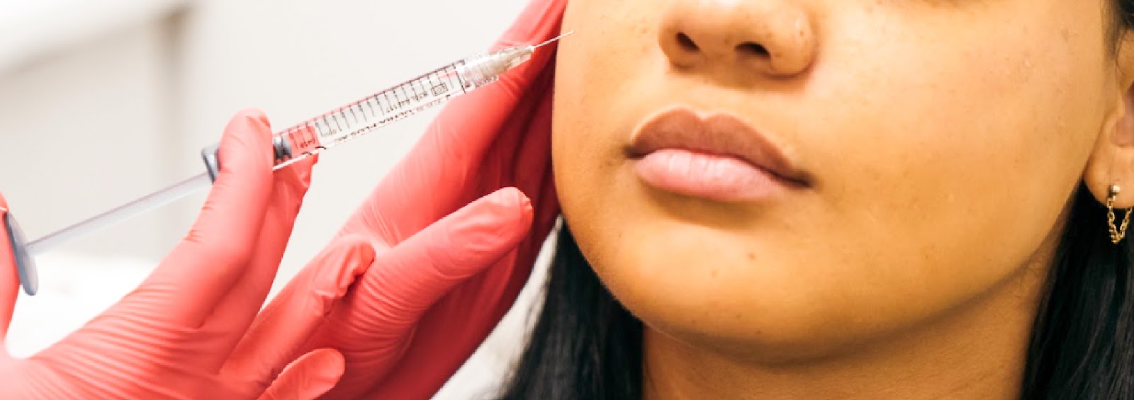 SkinDC&rsquo;s Guide to Dermal Fillers