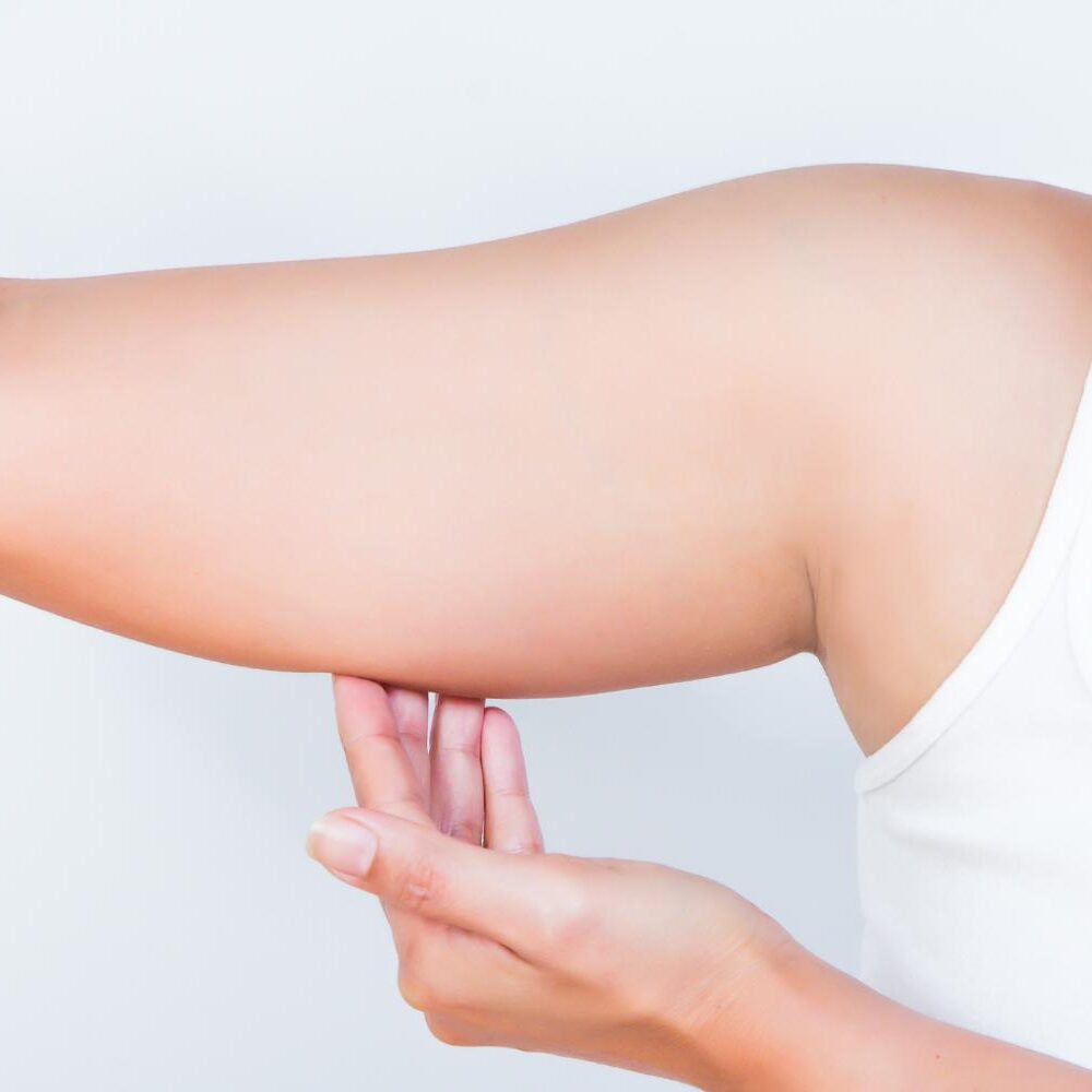 Botox for Hyperhidrosis
